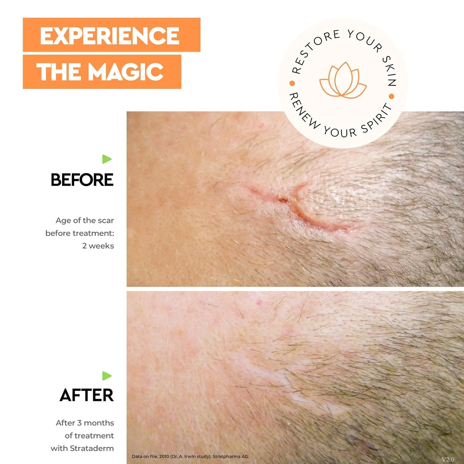 Strataderm, 10 g Gel Siliconic pentru Terapia Profesională a Cicatricilor [1]